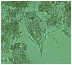 写真：反応タンクの中の微生物